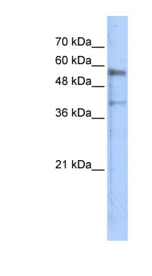 KREMEN1 / KREMEN-1 Antibody (aa71-120)