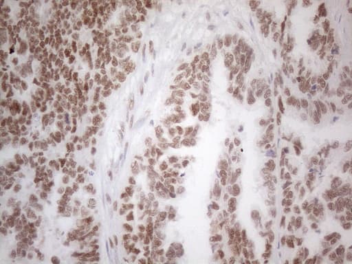 HDAC2 Antibody (aa415-488, clone OTI7E10)