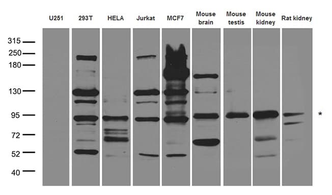 Polyclonal Rabbit anti-Human CUX1 / CASP Antibody (WB)