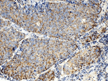 Polyclonal Rabbit anti-Human TECTA Antibody (IHC, WB)