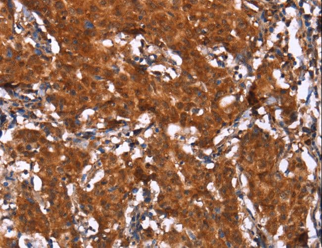 HCAR2 / NIACR1 Antibody