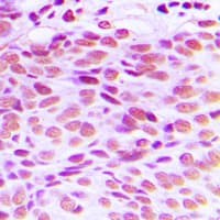 GATA4 Antibody (Internal)