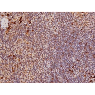 Polyclonal Rabbit anti-Human MAPT / Tau Antibody (phospho-Ser235, IHC, WB)