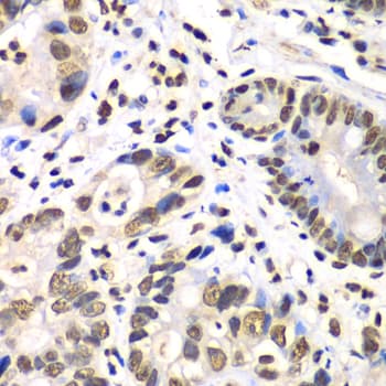 RBBP7 / RbAp46 Antibody