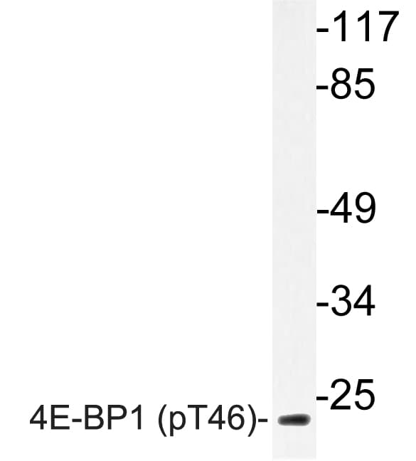 EIF4EBP1 / 4EBP1 Antibody (phospho-Thr46)