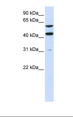 Polyclonal Rabbit anti-Human PTDSS1 Antibody (N-Terminus, IHC, WB)