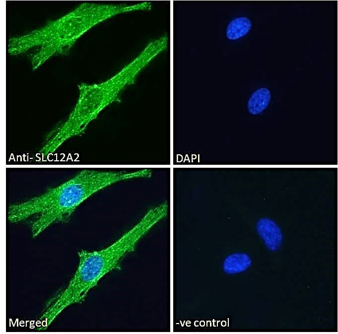 IHC-plus™ Polyclonal Goat anti-Human SLC12A2 / NKCC1 Antibody (aa769-783, IHC, IF)