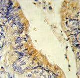 MCAD / ACADM Antibody (aa189-217)