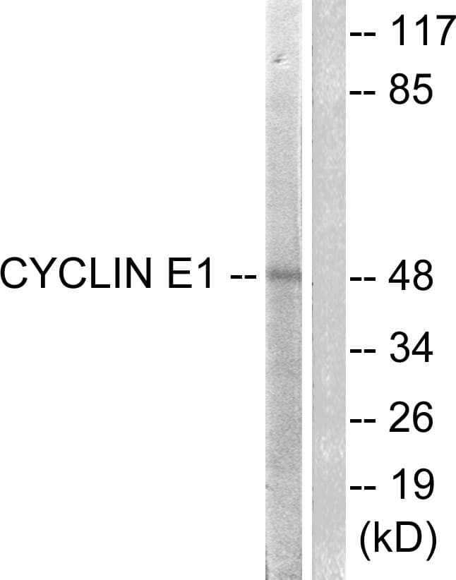 PathPlus™ CCNE1 / Cyclin E1 Antibody (aa361-410)