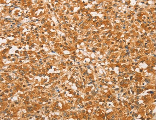 BCL2L14 / BCL-G Antibody