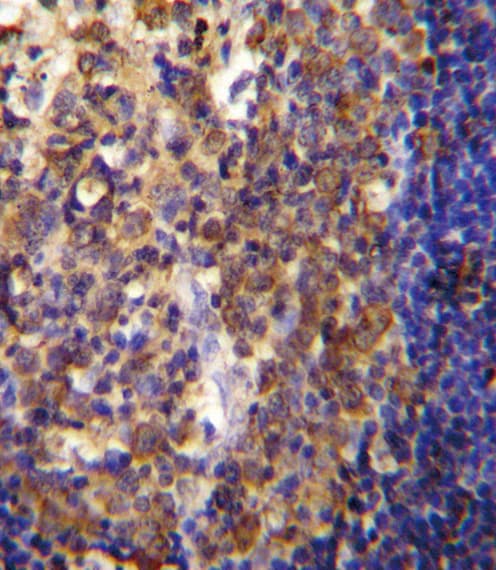 Polyclonal Rabbit anti-Human PTPRJ / CD148 Antibody (IHC, IF, WB)