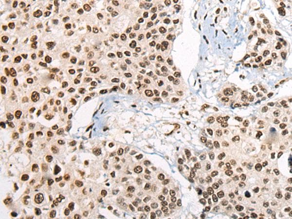 RTCB / C22orf28 Antibody