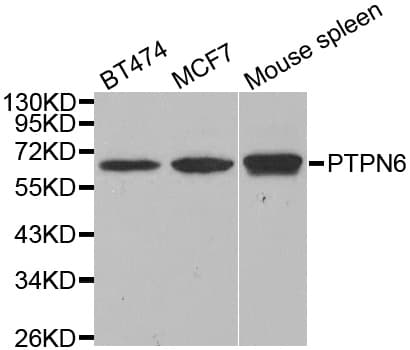 PTPN6 / SHP1 Antibody