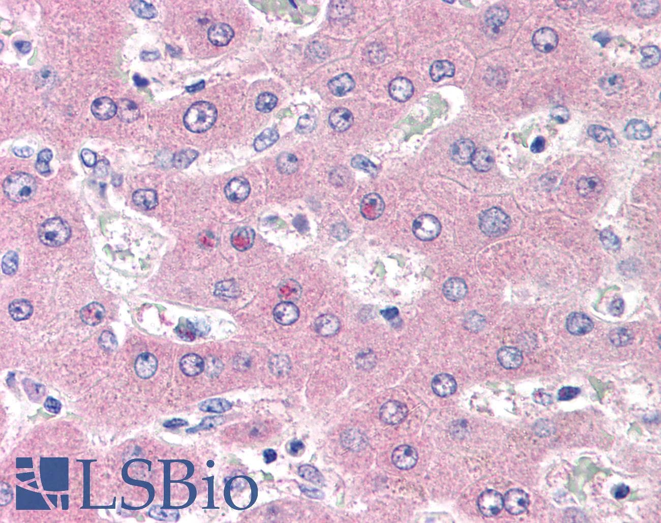 IHC-plus™ Monoclonal Mouse anti-Human CD98 Antibody (clone MEM-108, IHC)