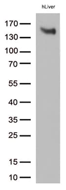 Monoclonal Mouse anti-Human LDLR / LDL Receptor Antibody (clone OTI7C5, Carrier-free, WB)