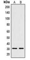 CTDSP1 / SCP1 Antibody (N-Terminus)