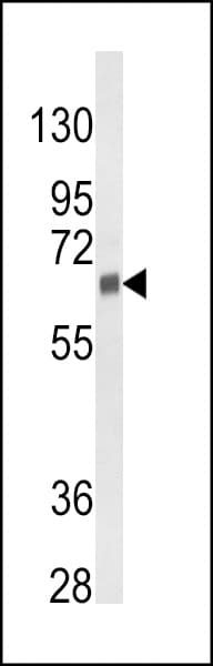 Polyclonal Rabbit anti-Human CYP3A5 Antibody (aa186-218, IHC, WB)