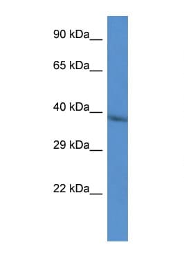 CTSV / Cathepsin V Antibody (aa111-160)