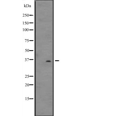 DNAJB6 Antibody