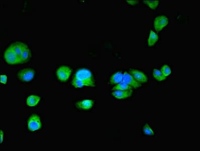 Polyclonal Rabbit anti-Human TPPP2 Antibody (IHC, WB)