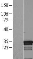 MED7 / CRSP9 Protein (Over-Expression Lysate Myc-DDK (Flag))
