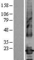 CLDN4 / Claudin 4 Protein (Over-Expression Lysate Myc-DDK (Flag))