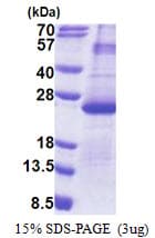 Human DUSP26 / MKP8 Protein (Recombinant His)
