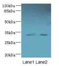 TMEM71 Antibody