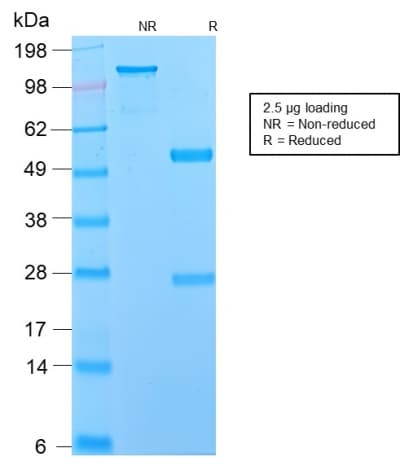 NGFR / CD271 / TNR16 Antibody (aa 281-421, clone NGFR/2550R)