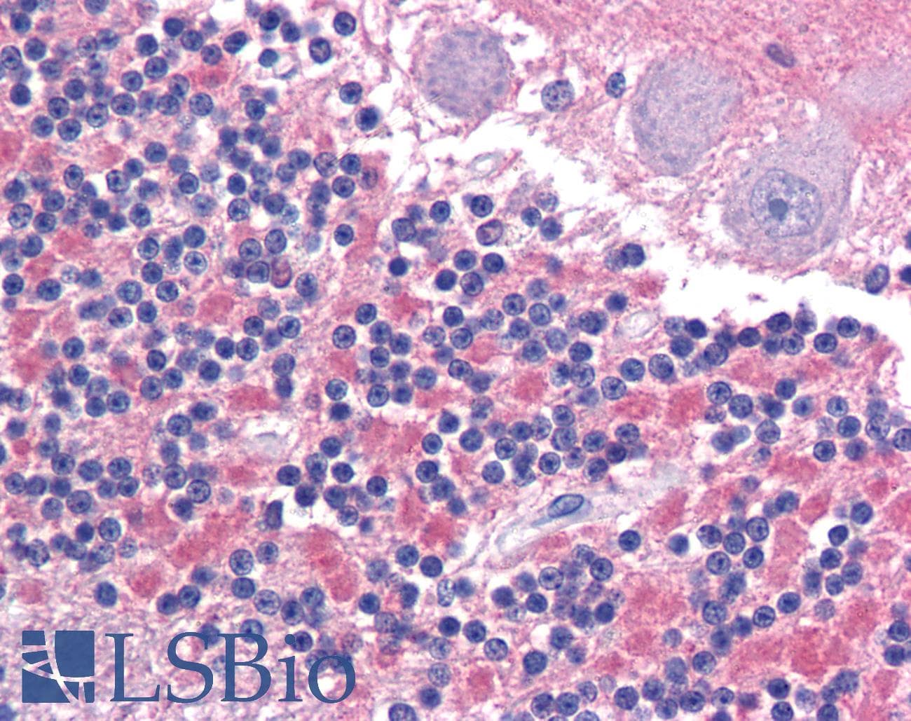 IHC-plus™ Polyclonal Rabbit anti-Human CADM2 Antibody (Internal, IHC)