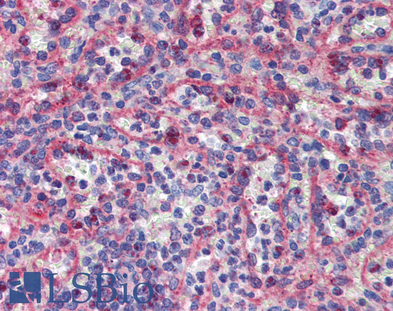 RAB6KIFL / KIF20A Antibody (C-Terminus)