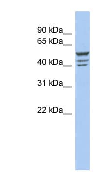 ZNF140 Antibody (C-Terminus)