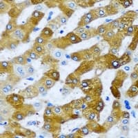 AARS2 Antibody