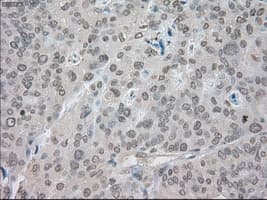 SATB1 Antibody (clone OTI13D6)