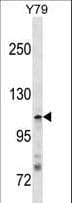 Polyclonal Rabbit anti-Human JMY Antibody (aa2-29, WB)