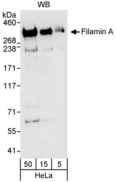 FLNA / Filamin A Antibody (aa400-450)
