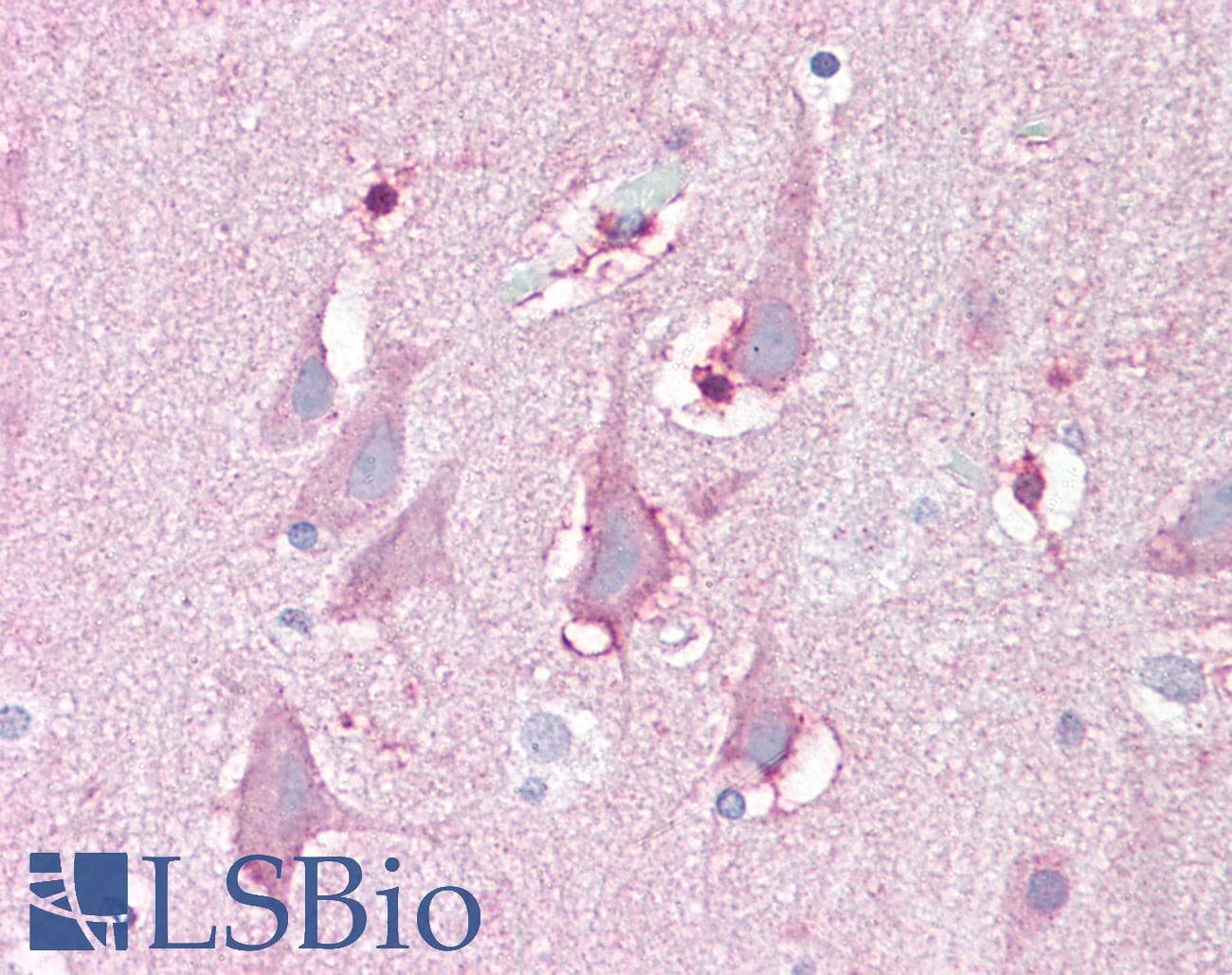 IHC-plus™ FBXL16 Antibody