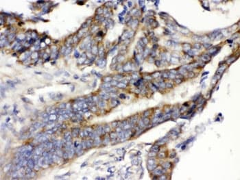 Polyclonal Rabbit anti-Human SLC2A5 / GLUT5 Antibody (IHC, WB)