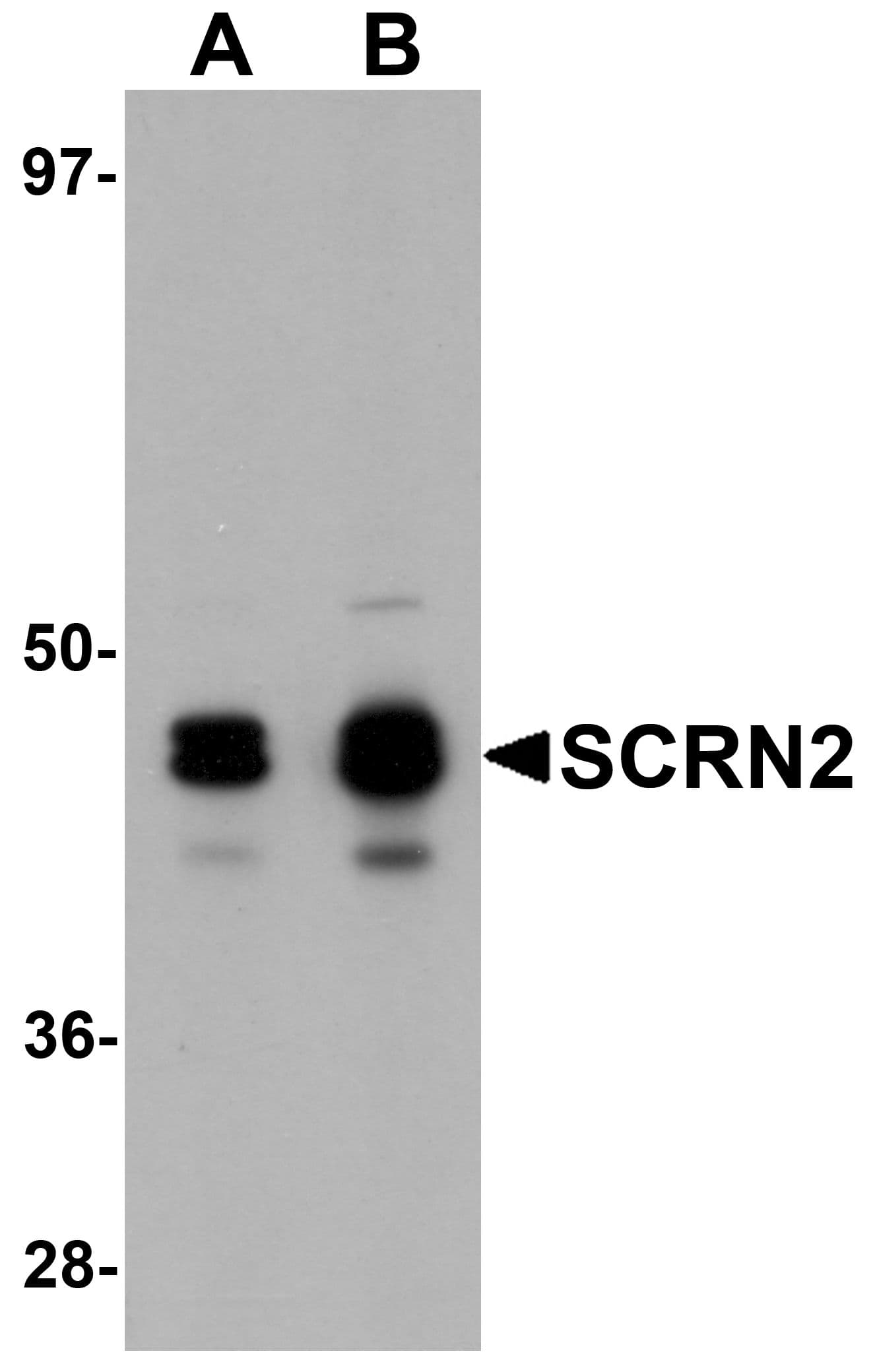 IHC-plus™ Polyclonal Rabbit anti-Human SCRN2 / Ses2 Antibody (IHC, IF, WB)