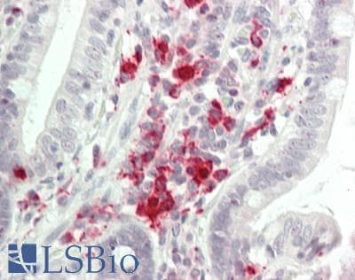 PathPlus™ TGFBR2 Antibody (aa517-567)