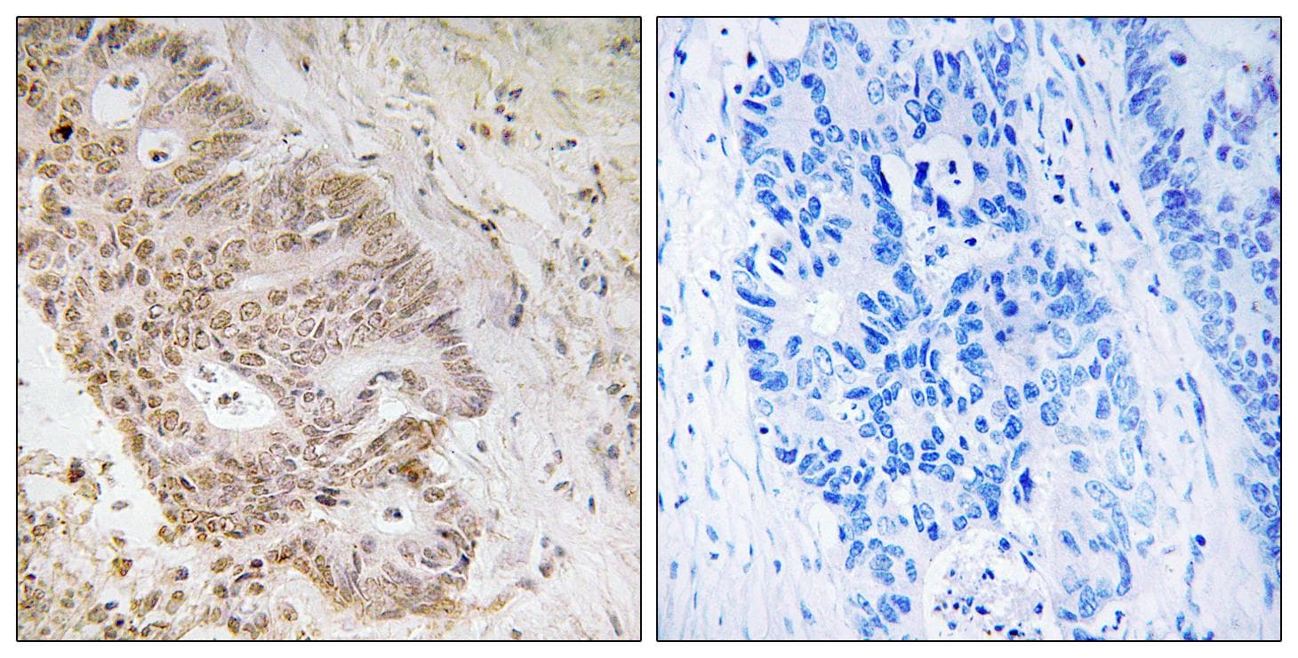 ZNF592 Antibody