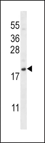 SDF1 / CXCL12 Antibody (aa64-92)