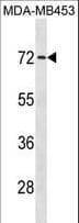 MEX3C Antibody (aa536-564)