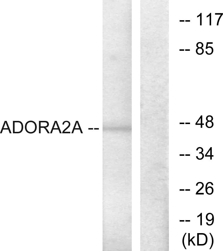 Polyclonal Rabbit anti-Human ADORA2A/Adenosine A2A Receptor Antibody (aa321-370, IHC, IF, WB)