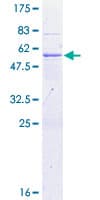Human DNAJC5 / CSP Protein (Recombinant GST)