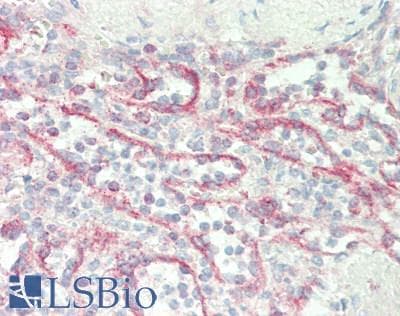 IHC-plus™ Polyclonal Rabbit anti-Human CDH11 / Cadherin 11 Antibody (IHC, WB)