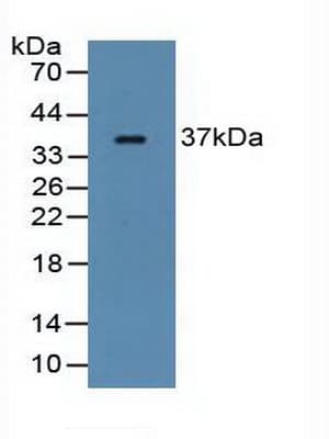 FCN1 / Ficolin-1 Antibody (aa25-279)