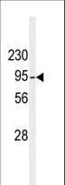 DGKB / DGK Beta Antibody (aa773-804)