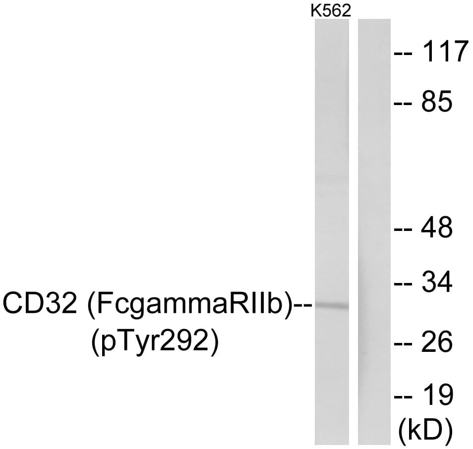 Polyclonal Rabbit anti-Human FCGR2 / CD32 Antibody (phospho-Tyr292, WB)