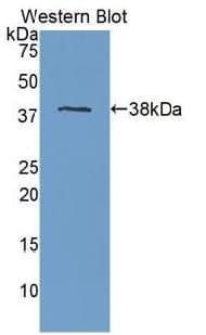 APOH / Apolipoprotein H Antibody (aa22-345)